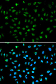 Immunofluorescence analysis of A549 cell using ATF6 antibody. Blue: DAPI for nuclear staining