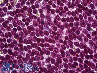 Anti-ATF6 antibody IHC of human spleen. Immunohistochemistry of formalin-fixed, paraffin-embedded tissue after heat-induced antigen retrieval. Antibody LS-B6032 concentration 10 ug/ml.