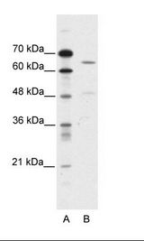 A: Marker, B: HepG2 Cell Lysate