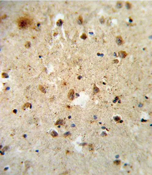 Formalin-fixed and paraffin-embedded human brain tissue reacted with ATF6 Antibody , which was peroxidase-conjugated to the secondary antibody, followed by DAB staining. This data demonstrates the use of this antibody for immunohistochemistry; clinical relevance has not been evaluated.