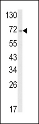 Western blot of ATF6 Antibody in A2058 cell line lysates (35 ug/lane). ATF6 (arrow) was detected using the purified antibody.
