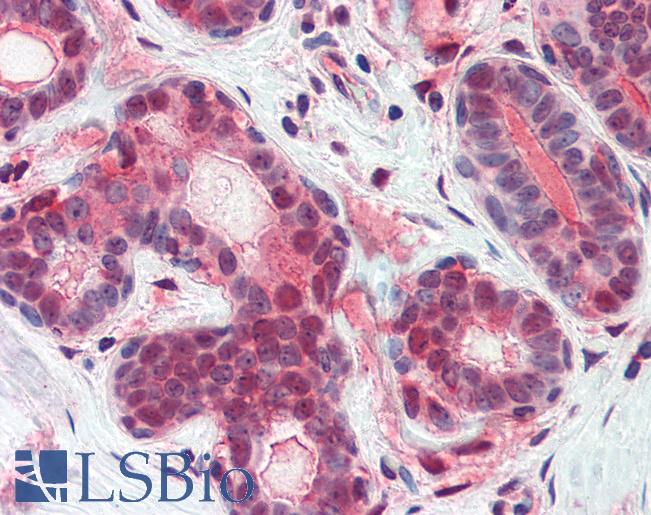 Anti-ATF6 antibody IHC of human breast. Immunohistochemistry of formalin-fixed, paraffin-embedded tissue after heat-induced antigen retrieval. Antibody LS-B2430 concentration 5 ug/ml.
