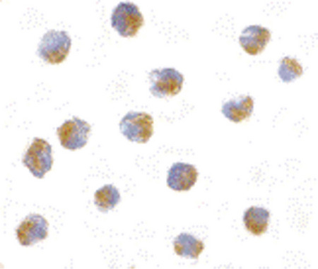 Immunocytochemistry of ATF6 in A20 with ATF6 antibody at 10 ug/ml.