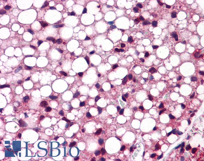 Anti-ATF6 antibody IHC of mouse adipose. Immunohistochemistry of formalin-fixed, paraffin-embedded tissue after heat-induced antigen retrieval. Antibody LS-B5587 concentration 5 ug/ml.