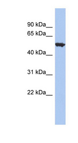 ACCN1 antibody LS-C110053 Western blot of THP-1 cell lysate.