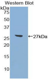 Western blot of recombinant ATF7.