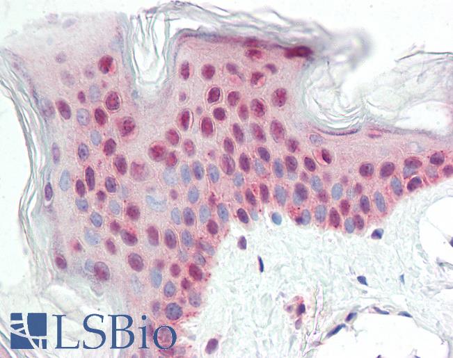 Anti-ATG14 antibody IHC staining of human skin. Immunohistochemistry of formalin-fixed, paraffin-embedded tissue after heat-induced antigen retrieval.