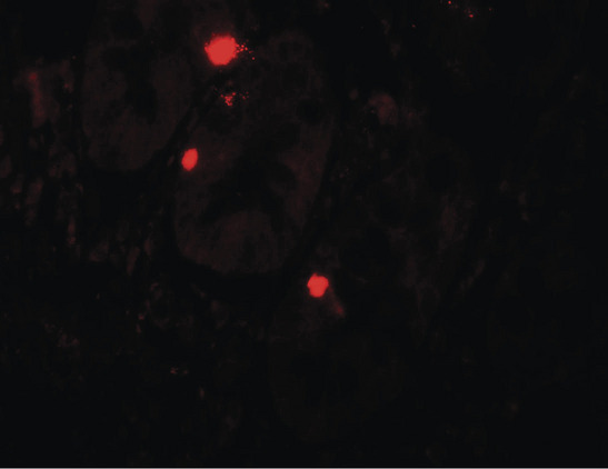 Immunofluorescence of ATG14 in human small intestine tissue with ATG14 antibody at 20 ug/ml.
