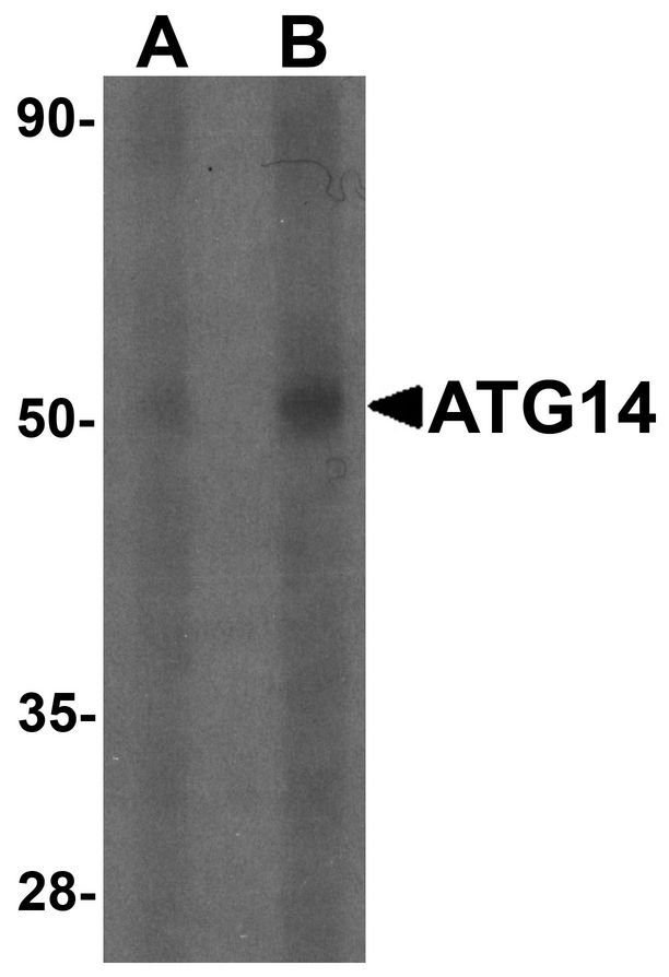 Western blot analysis of ATG14 in human small intestine tissue lysate with ATG14 antibody at (A) 1 and (B) 2 ug/ml.