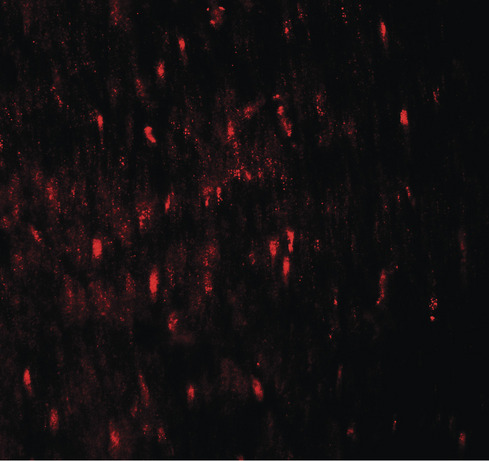 Immunofluorescence of WIPI1 in human colon tissue with WIPI1 antibody at 20 ug/ml.