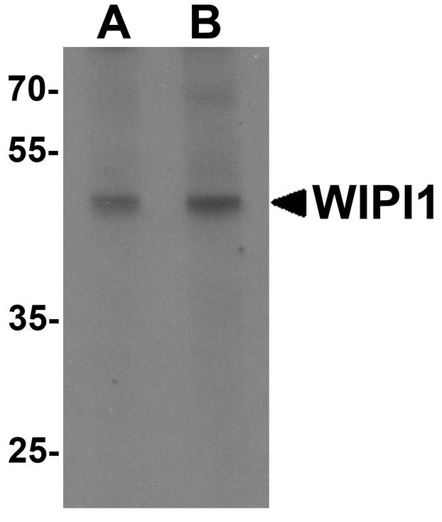 Western blot analysis of WIPI1 in rat colon tissue lysate with WIPI1 antibody at (A) 1 and (B) 2 ug/ml.