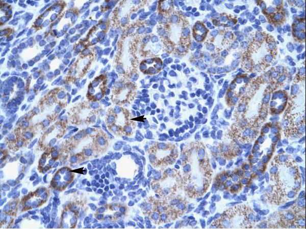 ACCN3 / ASIC3 antibody LS-C31243 was used in IHC to stain formalin-fixed, paraffin-embedded human kidney.