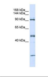 293T cell lysate. Antibody concentration: 1.0 ug/ml. Gel concentration: 6-18%.