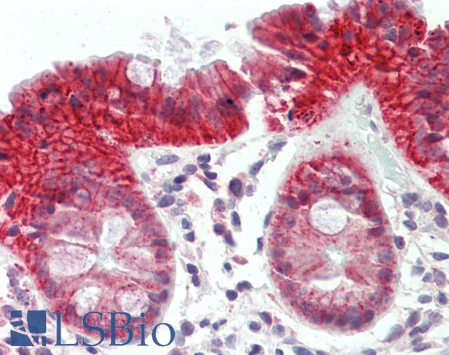 Anti-ATG2B antibody IHC staining of human colon. Immunohistochemistry of formalin-fixed, paraffin-embedded tissue after heat-induced antigen retrieval.