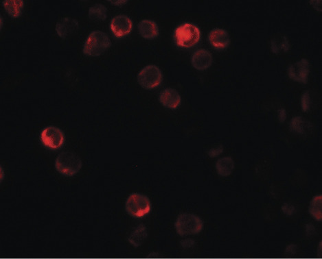 Immunofluorescence of ATG2B in K562 cells with ATG2B antibody at 20 ug/ml.