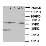 WB of ACCN3 / ASIC3 antibody. Lane 1: Rat Brain Tissue Lysate. Lane 2: Rat Testis Tissue Lysate. Lane 3: U87 Cell Lysate. Lane 4: NEURO Cell Lysate. Lane 5: SMMC Cell Lysate.