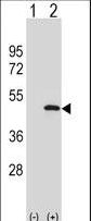Western blot of APG3L (arrow) using rabbit polyclonal APG3L Antibody (I98). 293 cell lysates (2 ug/lane) either nontransfected (Lane 1) or transiently transfected (Lane 2) with the APG3L gene.