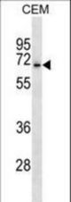 ACCN3 Antibody western blot of CEM cell line lysates (35 ug/lane). The ACCN3 antibody detected the ACCN3 protein (arrow).