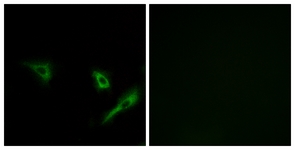 Immunofluorescence of A549 cells, using ATG4A Antibody. The picture on the right is treated with the synthesized peptide.