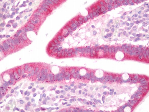 Human Small Intestine: Formalin-Fixed, Paraffin-Embedded (FFPE)