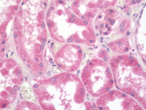 Human Kidney: Formalin-Fixed, Paraffin-Embedded (FFPE)
