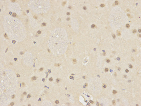 Immunohistochemistry of paraffin-embedded rat brain using ATG4A antibody at dilution of 1:200 (400x lens).