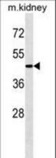 APG4A Antibody (I378) western blot of mouse kidney tissue lysates (35 ug/lane). The APG4A antibody detected the APG4A protein (arrow).