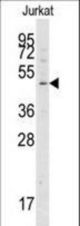 Western blot of anti-APG4A antibody in Jurkat cell line lysates (35 ug/lane). APG4A (arrow) was detected using the purified antibody.