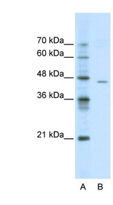 ACCN4 antibody LS-B920 Western blot of Jurkat lysate.