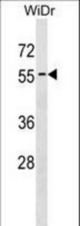 APG4D Antibody (Center S341) western blot of WiDr cell line lysates (35 ug/lane). The APG4D antibody detected the APG4D protein (arrow).