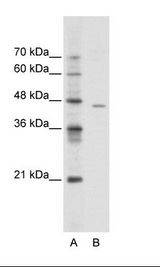 A: Marker, B: Jurkat Cell Lysate
