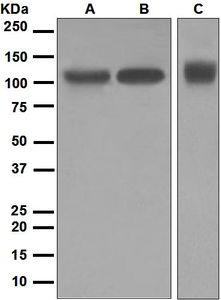Western blot analysis on (A) A375, (B) HepG2, and (C) 293T cell lysates using anti-ATG9A antibody.