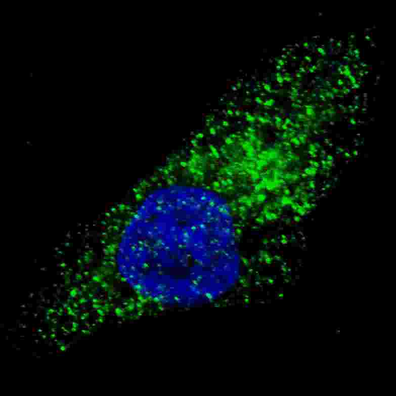 Fluorescent image of U251 cells stained with ATG9A antibody. U251 cells were treated with Chloroquine (50 mu M,16h), then fixed with 4% PFA (20 min), permeabilized with Triton X-100 (0.2%, 30 min). Cells were then incubated ATG9A primary antibody (1:100, 2 h at room temperature). For secondary antibody, Alexa Fluor 488 conjugated donkey anti-rabbit antibody (green) was used (1:1000, 1h). Nuclei were counterstained with Hoechst 33342 (blue) (10 ug/ml, 5 min). ATG9A immunoreactivity is localized to autophagic vacuoles in the cytoplasm of U251 cells.