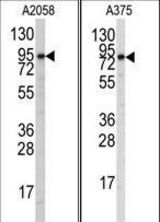 Western blot of anti-Autophagy APG9L1 Antibody in A2058 and A375 cell line lysates (35 ug/lane). APG9L1(arrow) was detected using the purified antibody.