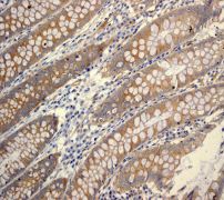 IHC of paraffin-embedded human colon tissue using anti-ATG9A antibody.