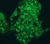 Immunofluorescent staining of HepG2 cells using anti-ATG9A antibody.