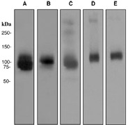 Western blot analysis on (A) HepG2, (B) 293T, (C) A375, (D) mouse brain, and (E) rat brain cell lysates using anti-ATG9A antibody.
