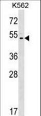 ACCN5 Antibody western blot of K562 cell line lysates (35 ug/lane). The ACCN5 antibody detected the ACCN5 protein (arrow).