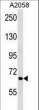 APG9L1 Antibody (W267) western blot of A2058 cell line lysates (35 ug/lane). The APG9L1 antibody detected the APG9L1 protein (arrow).