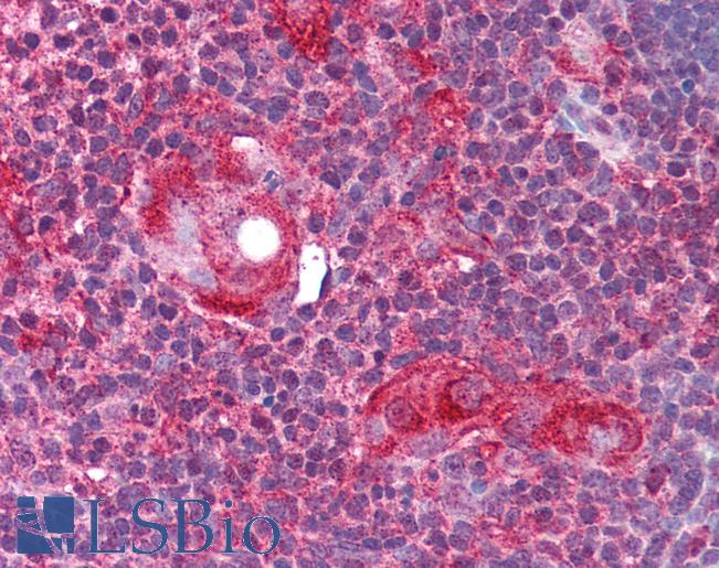Anti-ATG9A antibody IHC of human thymus. Immunohistochemistry of formalin-fixed, paraffin-embedded tissue after heat-induced antigen retrieval. Antibody LS-B661 concentration 5 ug/ml.