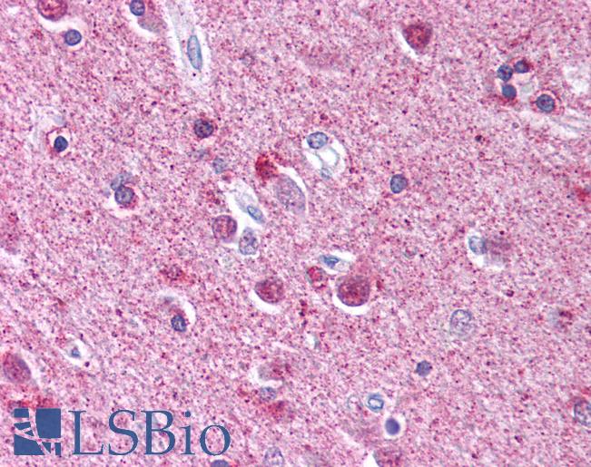 Anti-ATG9A antibody IHC of human brain, cortex. Immunohistochemistry of formalin-fixed, paraffin-embedded tissue after heat-induced antigen retrieval. Antibody LS-B661 concentration 5 ug/ml.