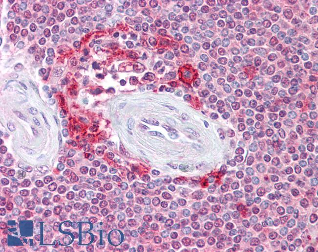 Anti-ATG9A antibody IHC of human spleen. Immunohistochemistry of formalin-fixed, paraffin-embedded tissue after heat-induced antigen retrieval. Antibody LS-B6984 concentration 5 ug/ml.