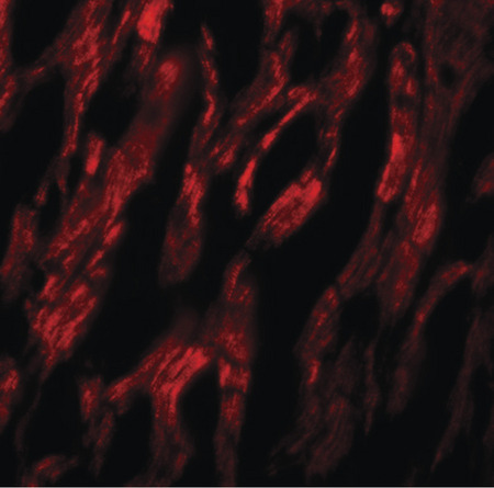 Immunofluorescence of ATG9A in human heart tissue with ATG9A antibody at 20 ug/ml.