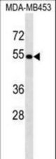 ACCS Antibody western blot of MDA-MB453 cell line lysates (35 ug/lane). The ACCS antibody detected the ACCS protein (arrow).
