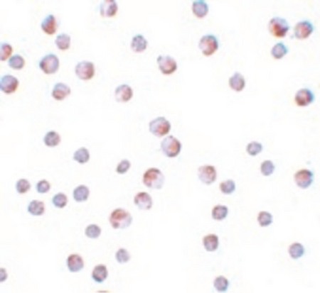 Immunocytochemistry of ATG9B in HeLa cells with ATG9B antibody at 10 ug/ml.