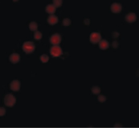 Immunofluorescence of ATG9B in HeLa cells with ATG9B antibody at 20 ug/ml.