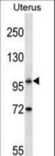 ATG9B Antibody western blot of human normal Uterus tissue lysates (35 ug/lane). The ATG9B antibody detected the ATG9B protein (arrow).