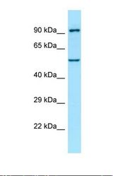 Western blot of Human Fetal Brain. SPG3A antibody dilution 1.0 ug/ml.