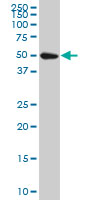 SPG3A monoclonal antibody (M10), clone 1B11. Western blot of SPG3A expression in IMR-32.