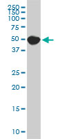 SPG3A monoclonal antibody (M10), clone 1B11. Western blot of SPG3A expression in PC-12.